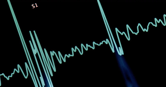 cardiac_safety solutions_standard_banner cardiac_safety solutions_standard_banner