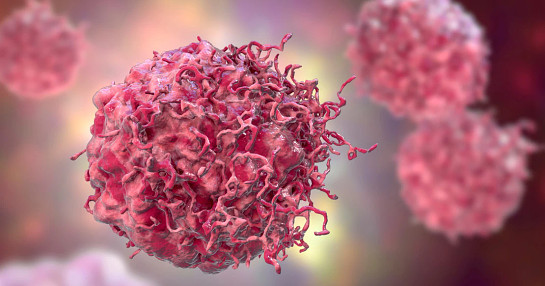 Clinical_Oncologist_Blogs_1110x678p_2_thumbnail