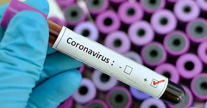 Covid-19-blogs_540x215