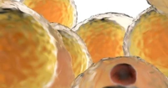 Diabesity_obesity_diabetes_blog thumbnail