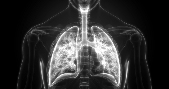 iStock_medical imaging_lungs black and white_1128216565