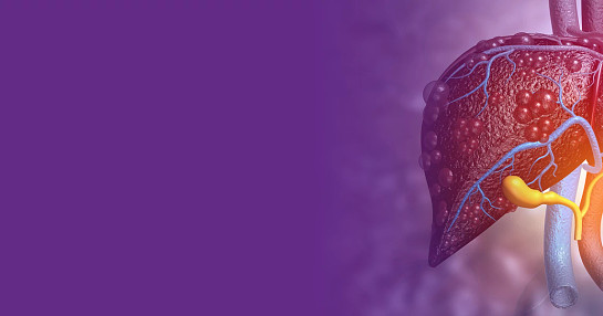 NASH-Subpage-Banner_1