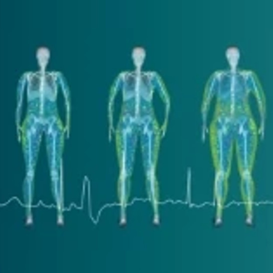 Human body illustration displayed in various stages of obesity.