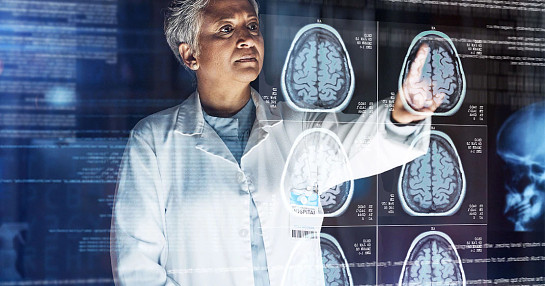 Thumbnail_1110x678_Role of AI in medical imaging_blog