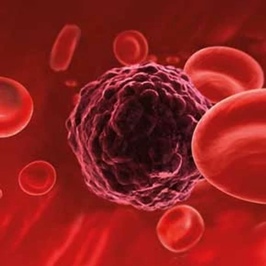 uuid_b063e314-b6be-4c76-b093-a567df95c8d4_oncology