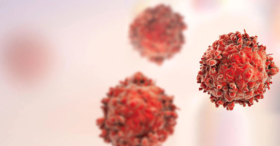 uuid_b2eca500-33b4-49c6-9e58-3dd91ca5594a_Oncology uuid_b2eca500-33b4-49c6-9e58-3dd91ca5594a_Oncology