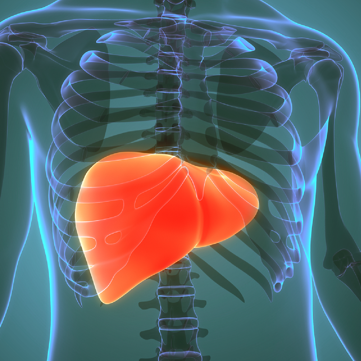 Obesity and metabolic-dysfunction associated steatotic liver disease.